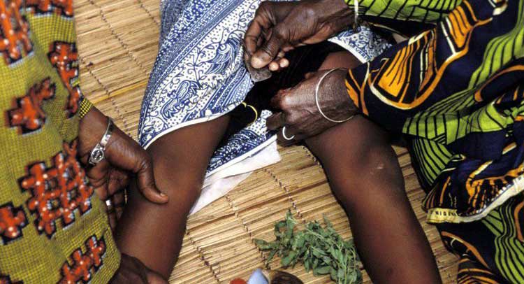 Female Genital Mutilation