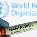 Here are five things to know about the recent hantavirus outbreak, including its symptoms and treatment