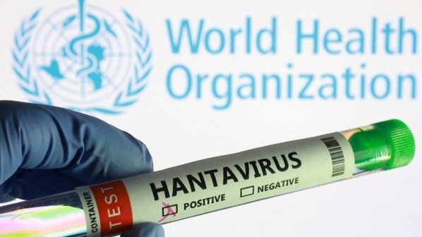 Here are five things to know about the recent hantavirus outbreak, including its symptoms and treatment
